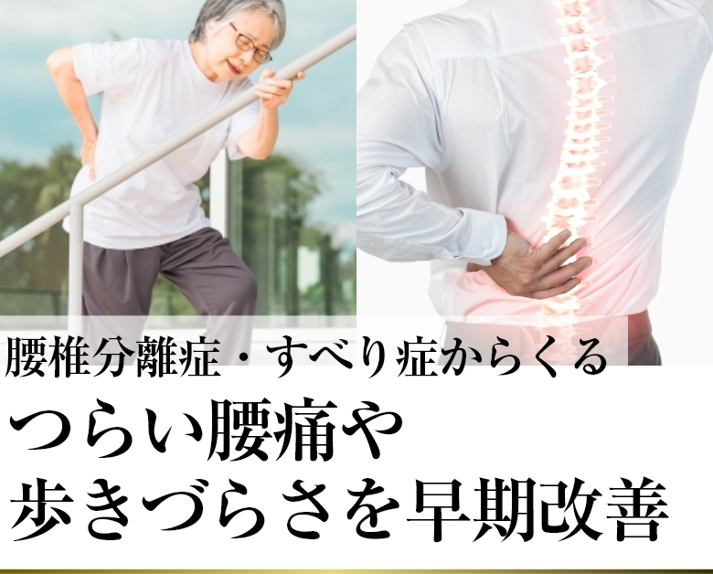 腰椎分離症・すべり症からくるつらい腰痛や歩きづらさを早期改善
